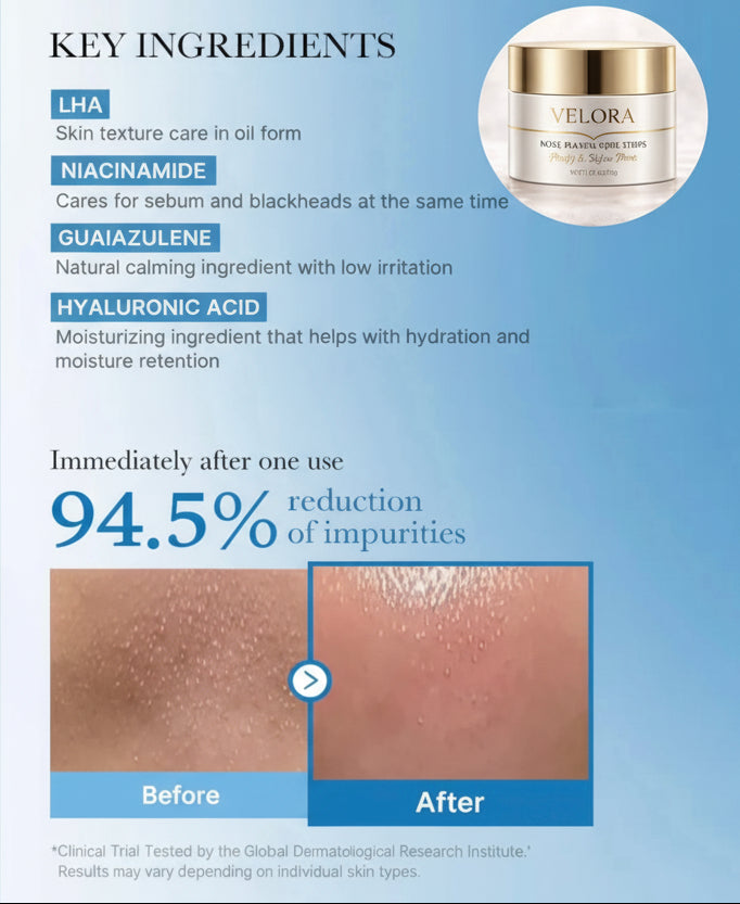 Velora™ Nose Pore Strips - German Formula